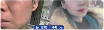 重庆 · 70后职员 · 用户养护记录