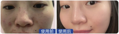 深圳 · 00后职员 · 用户养护记录